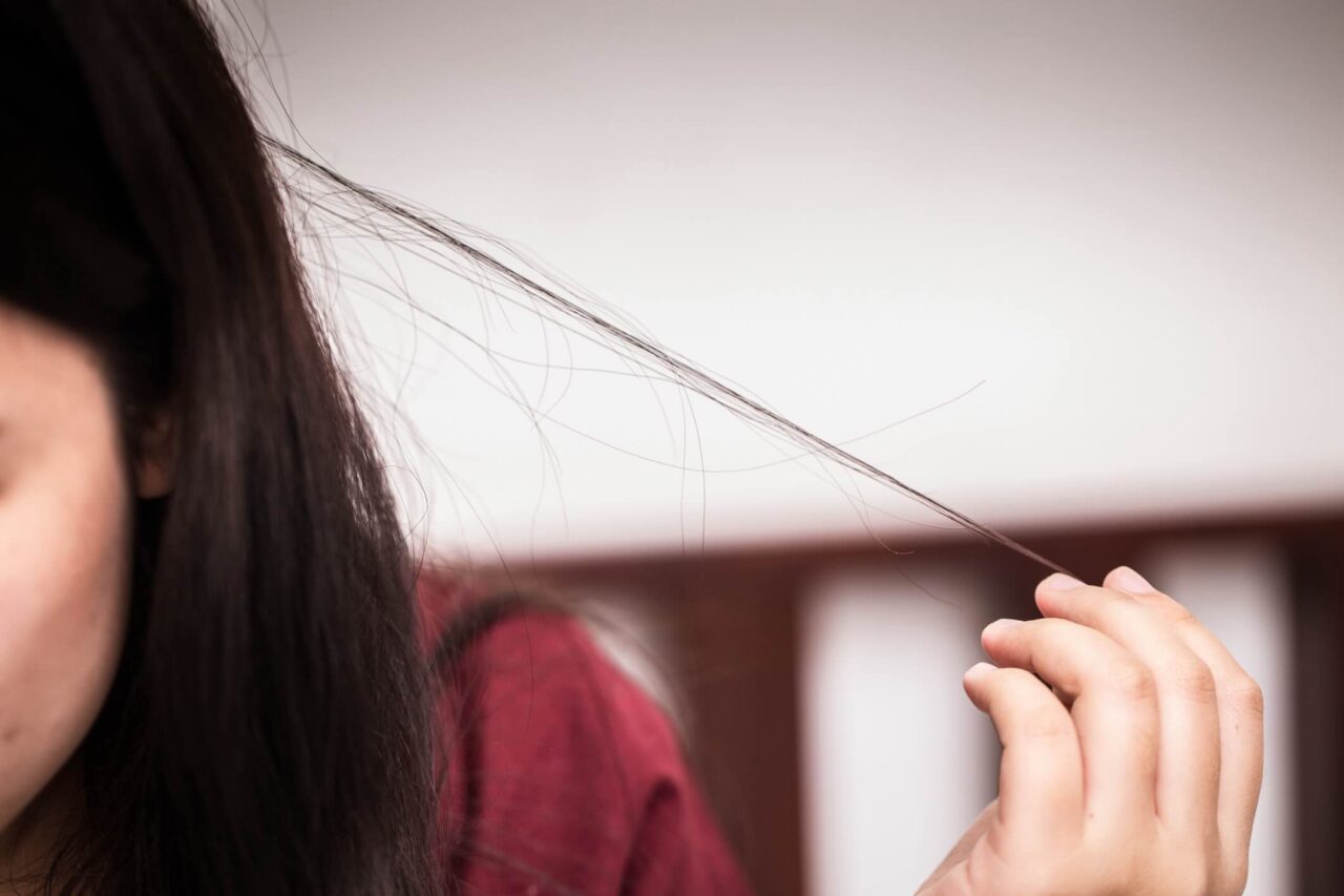 Trichotillomania (Hair-Pulling)